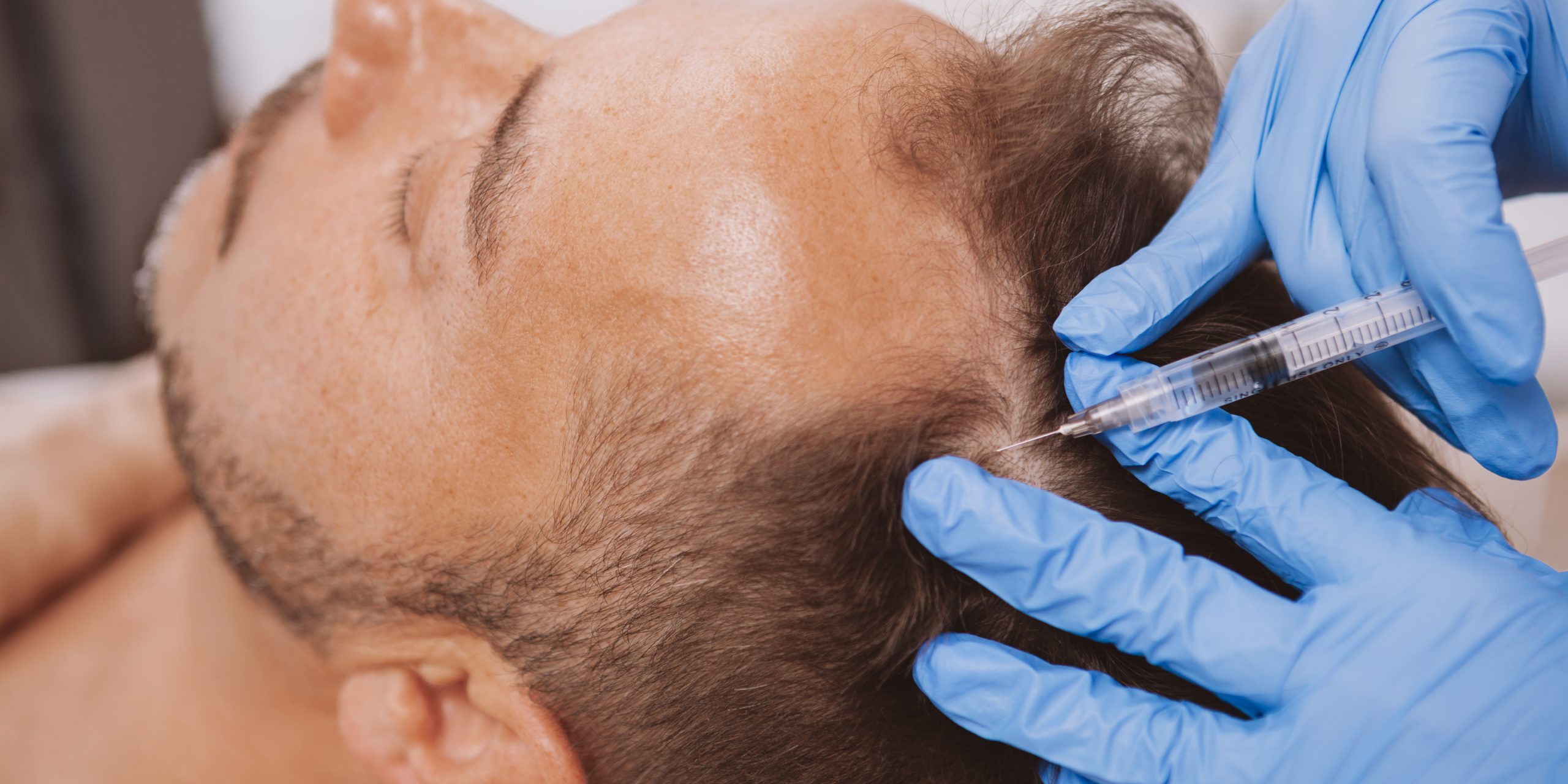 PRP-TRICOLOGIA PRP-TRICOLOGIA-TECNOMED-VERONA