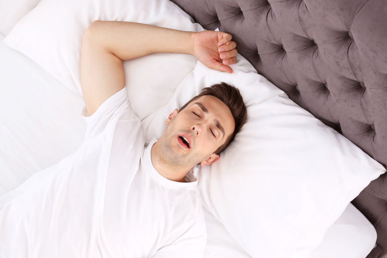 Apnea ostruttiva nel sonno (osa)